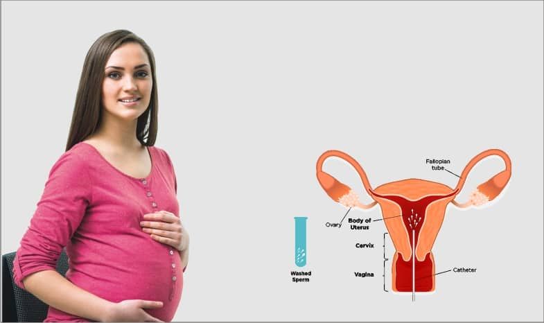 Is IUI Procedure Painful?