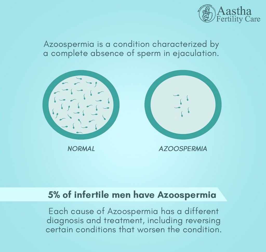 Azoospermia