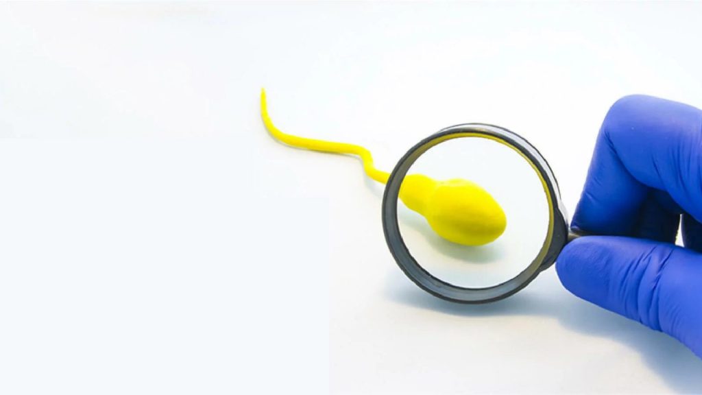 Low sperm motility